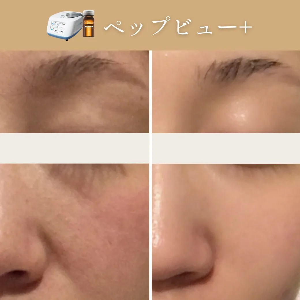 ペップビュー＋